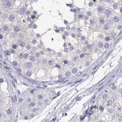 Immunohistochemistry-Paraffin: IGSF1 Antibody [NBP2-14119]