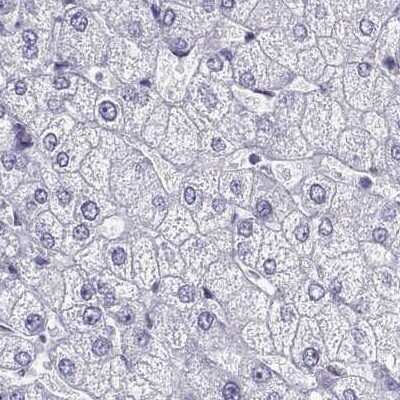 Immunohistochemistry-Paraffin: IGSF1 Antibody [NBP2-14119]
