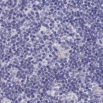 Immunohistochemistry-Paraffin: IGSF1 Antibody [NBP2-14119]