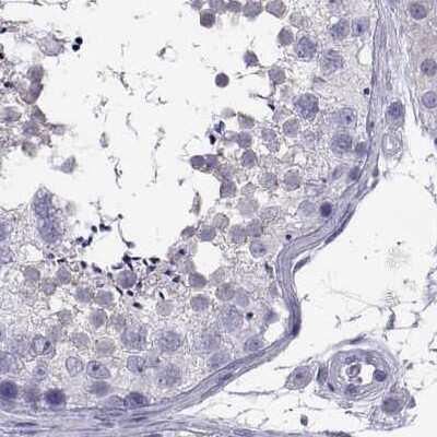 Immunohistochemistry-Paraffin: IGSF1 Antibody [NBP2-68582]
