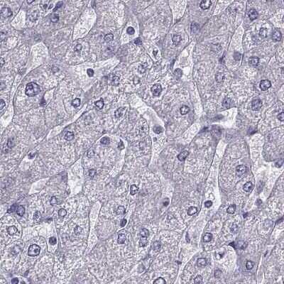 Immunohistochemistry-Paraffin: IGSF1 Antibody [NBP2-68582]