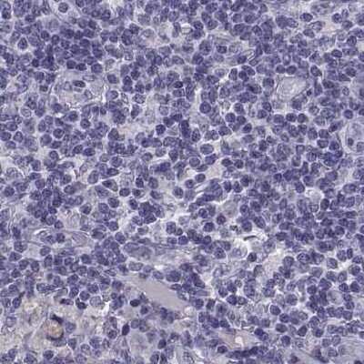 Immunohistochemistry-Paraffin: IGSF1 Antibody [NBP2-68582]