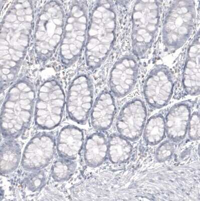 Immunohistochemistry-Paraffin: IGSF21 Antibody [NBP1-81191]