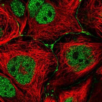 Immunocytochemistry/ Immunofluorescence: IGSF23 Antibody [NBP2-33630]