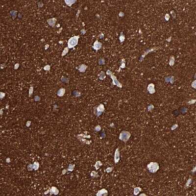 Immunohistochemistry-Paraffin: IGSF4B/SynCAM3/CADM3 Antibody [NBP1-88604]