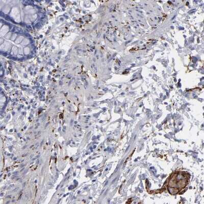 Immunohistochemistry-Paraffin: IGSF4B/SynCAM3/CADM3 Antibody [NBP1-88604]