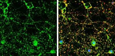 Immunocytochemistry/ Immunofluorescence: IGSF4C/SynCAM4 Antibody [NBP3-13192]