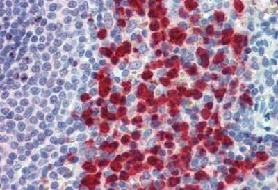 Immunohistochemistry-Paraffin: IGSF4C/SynCAM4 Antibody [NB100-93383]