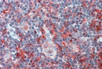Immunohistochemistry-Paraffin: IGSF4C/SynCAM4 Antibody [NBP1-00164]