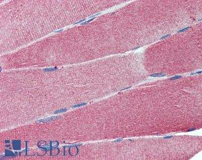 Immunohistochemistry-Paraffin: IGSF4C/SynCAM4 Antibody [NBP1-00164]