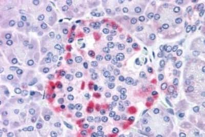 Immunohistochemistry-Paraffin: IGSF4C/SynCAM4 Antibody [NBP3-14360]