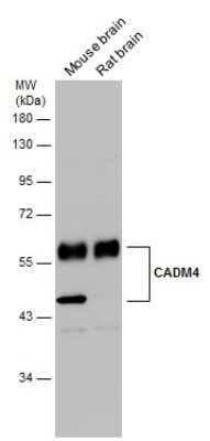 Western Blot: IGSF4C/SynCAM4 Antibody [NBP3-13192]