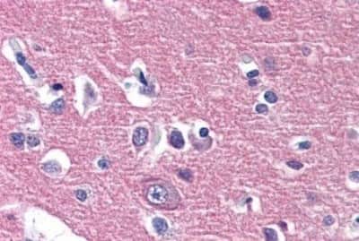 Immunohistochemistry-Paraffin: IGSF4D/SynCAM2/CADM2 Antibody [NBP3-14375]