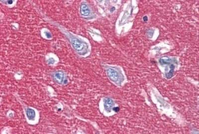 Immunohistochemistry-Paraffin: IGSF4D/SynCAM2/CADM2 Antibody [NBP3-14376]