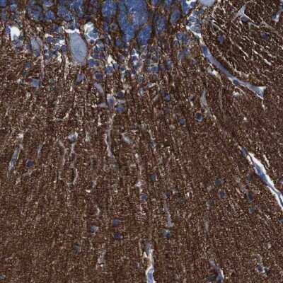 Immunohistochemistry-Paraffin: IGSF8/CD316 Antibody [NBP1-85761]