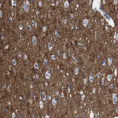 Immunohistochemistry-Paraffin: IGSF8/CD316 Antibody [NBP1-85761]