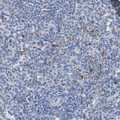 Immunohistochemistry-Paraffin: IGSF8/CD316 Antibody [NBP1-85761]