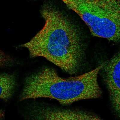 Immunocytochemistry/ Immunofluorescence: IKBKAP Antibody [NBP2-56082]