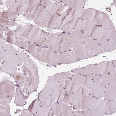 Immunohistochemistry-Paraffin: IKIP Antibody [NBP2-56525]