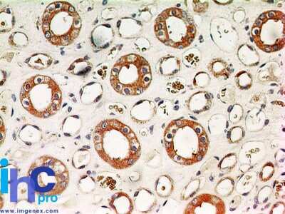 Immunohistochemistry-Paraffin: IKK alpha Antibody (14A231) - Azide Free [NBP2-27409]