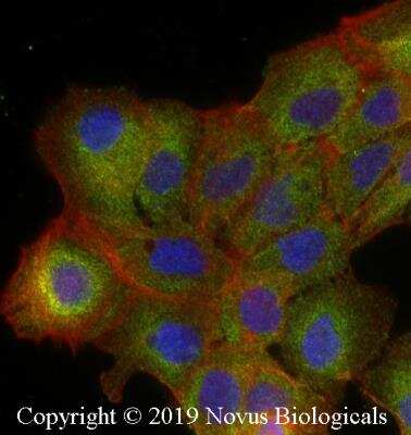 Immunocytochemistry/ Immunofluorescence: IKK alpha Antibody (14A231) - BSA Free [NB100-56704]
