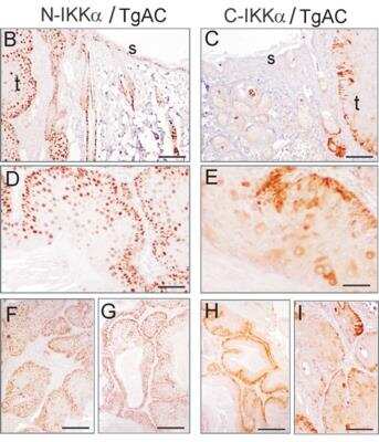 Immunohistochemistry: IKK alpha Antibody (14A231) - BSA Free [NB100-56704]