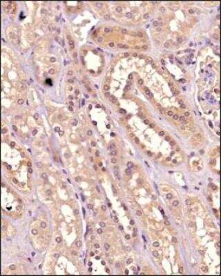 Immunohistochemistry-Paraffin: IKK alpha Antibody (14A231) - BSA Free [NB100-56704]