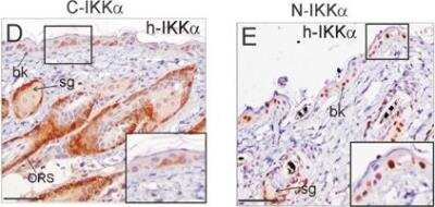 Immunohistochemistry-Paraffin: IKK alpha Antibody (14A231) - BSA Free [NB100-56704]