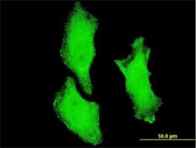 Immunocytochemistry/ Immunofluorescence: IKK alpha Antibody (4D11) [H00001147-M01]