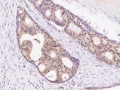 Immunohistochemistry: IKK alpha Antibody [NBP2-99049]