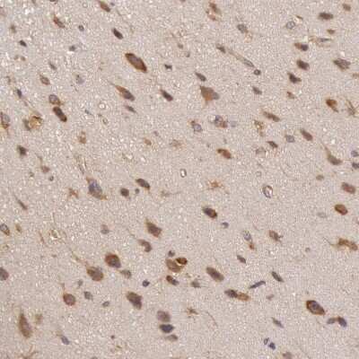 Immunohistochemistry-Paraffin: IKK alpha Antibody [NBP1-89634]