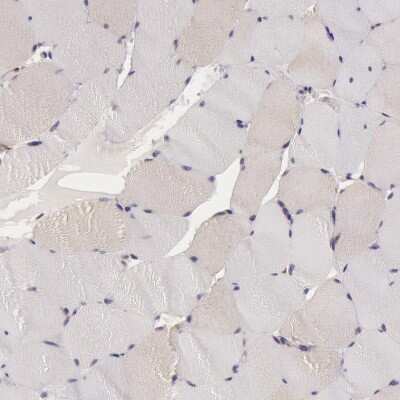 Immunohistochemistry-Paraffin: IKK alpha Antibody [NBP1-89634]