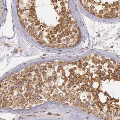 Immunohistochemistry-Paraffin: IKK alpha Antibody [NBP1-89634]