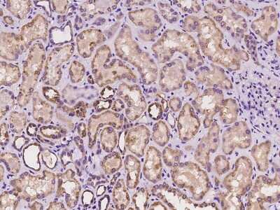Immunohistochemistry-Paraffin: IKK alpha Antibody [NBP2-97348]
