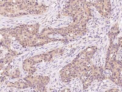 Immunohistochemistry-Paraffin: IKK alpha Antibody [NBP2-99049]