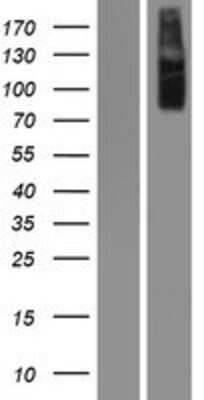 Western Blot: IKK alpha Overexpression Lysate [NBP2-04194]