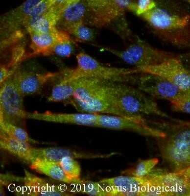 Immunocytochemistry/ Immunofluorescence: IKK beta Antibody (10AG2) - Azide and BSA Free [NBP2-80788]