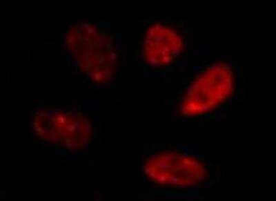 Immunocytochemistry/ Immunofluorescence: IKK beta Antibody (10AG2) - BSA Free [NB100-56509]