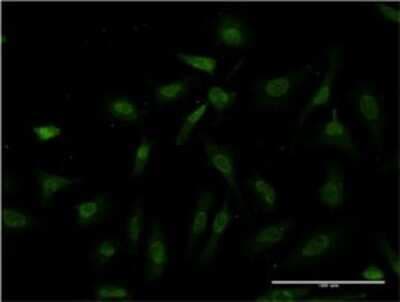 Immunocytochemistry/ Immunofluorescence: IKK beta Antibody (3C12) [H00003551-M08]