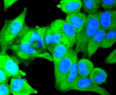 Immunocytochemistry/ Immunofluorescence: IKK beta Antibody (SN63-02) [NBP2-67659]