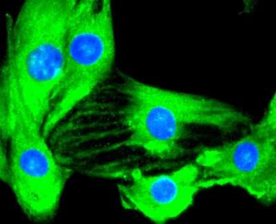 Immunocytochemistry/ Immunofluorescence: IKK beta Antibody (SN63-02) [NBP2-67659]
