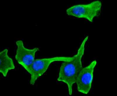Immunocytochemistry/ Immunofluorescence: IKK beta Antibody (SN63-02) [NBP2-67659]