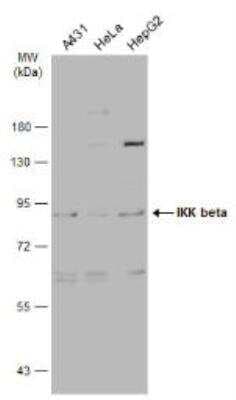 Western Blot: IKK beta Antibody [NBP1-32258]