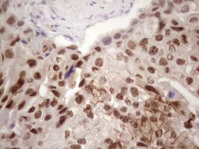Immunohistochemistry: IKK epsilon/IKBKE Antibody (OTI3C5) [NBP2-46047]