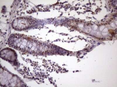 Immunohistochemistry: IKK epsilon/IKBKE Antibody (OTI3C5) [NBP2-46047]