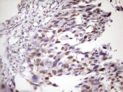 Immunohistochemistry: IKK epsilon/IKBKE Antibody (OTI3C5) [NBP2-46047]