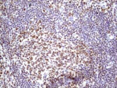Immunohistochemistry: IKK epsilon/IKBKE Antibody (OTI3C5) [NBP2-46047]