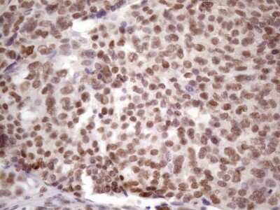 Immunohistochemistry: IKK epsilon/IKBKE Antibody (OTI3C5) [NBP2-46047]