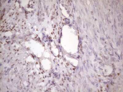 Immunohistochemistry: IKK epsilon/IKBKE Antibody (OTI3C5) [NBP2-46047]