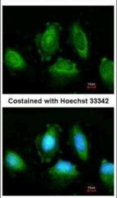 Immunocytochemistry/ Immunofluorescence: IKK epsilon/IKBKE Antibody [NBP1-33052]